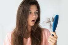 Muốn trị chứng rụng tóc, cần giải quyết 4 vấn đề này