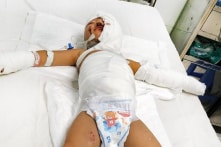 Ném ‘bom xăng’ kinh hoàng: Bé 3 tuổi bị nhiễm trùng nặng